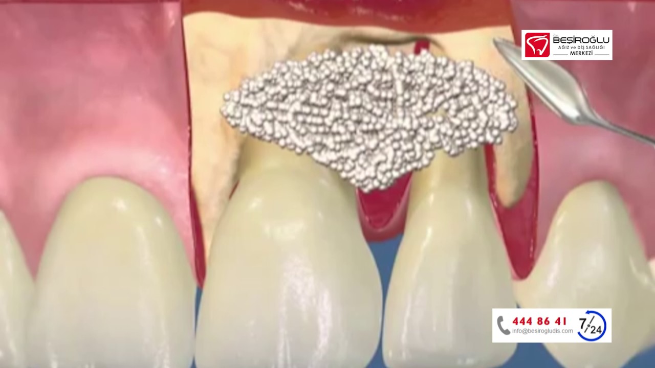 Diş eti hastalıkları ve cerrahisi uzmanı Dr. Burak Hamzaçebi